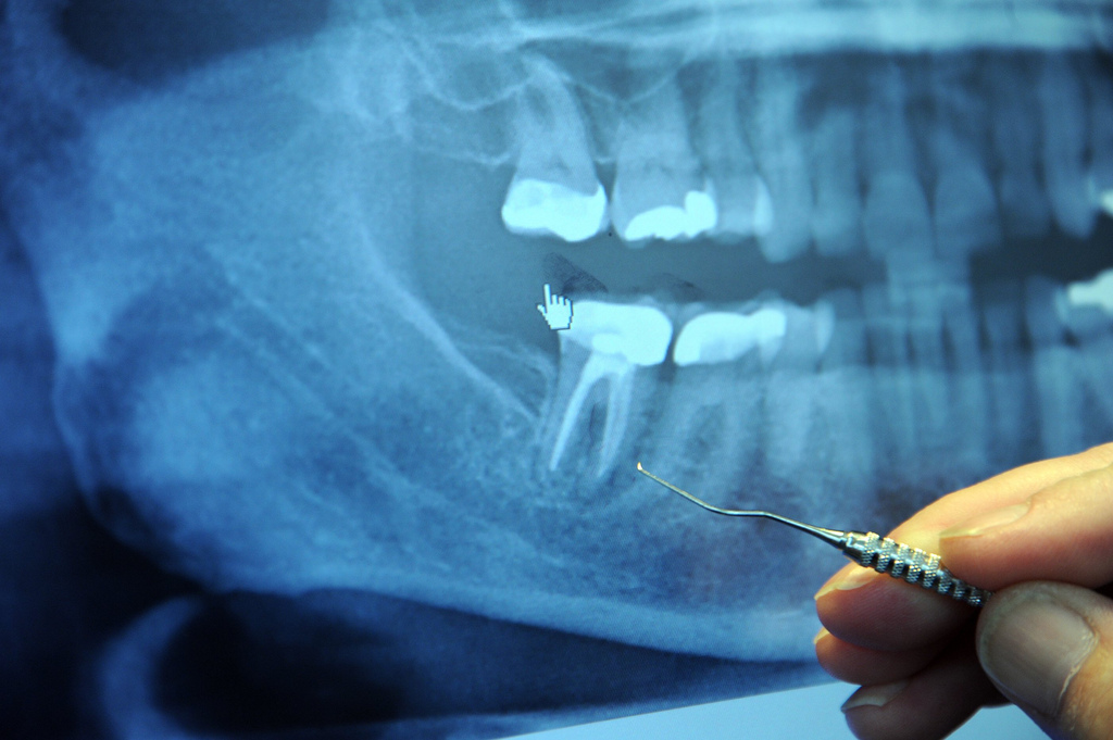What Happens When You Don’t See A Dentist For 13 Years