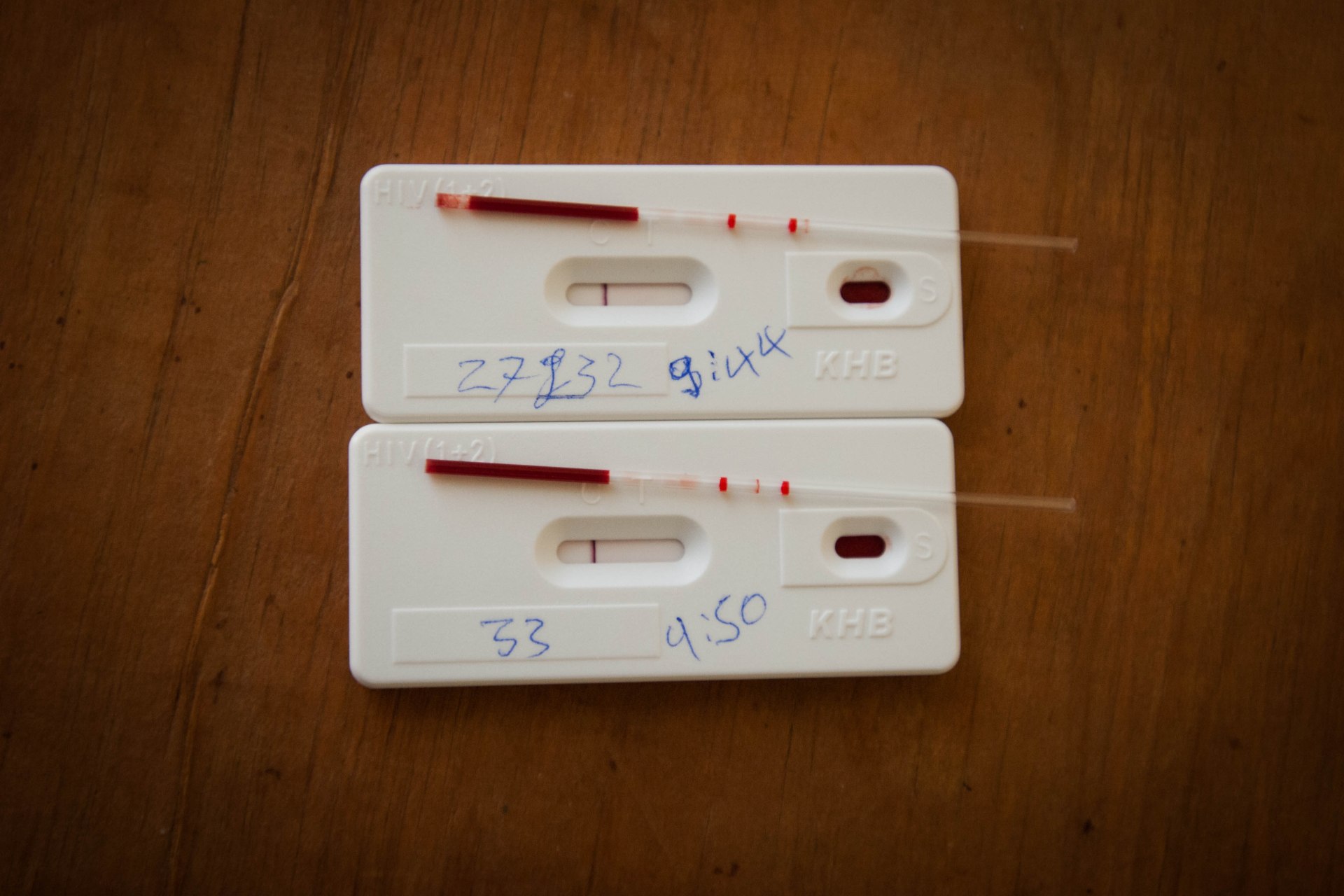 I Found Out My Girlfriend Of 4 Months Is HIV Positive