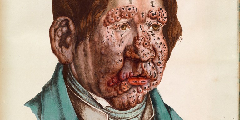 Sick Roses: Disease And The Art Of Medical Illustration