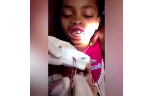 You Won’t Believe This Video: A Dentist Removes 15 Maggots From A 10-Year-Old Girl’s Gums.