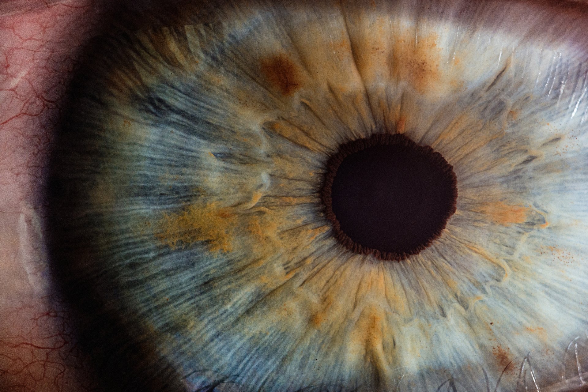 You Might Think Twice About Getting Laser Eye Surgery After You Read This Story