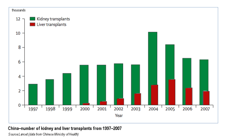 Transplants