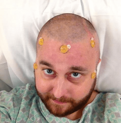 Man With Skin Cancer Chronicles His Journey In This Heart-Wrenching Photo Journal