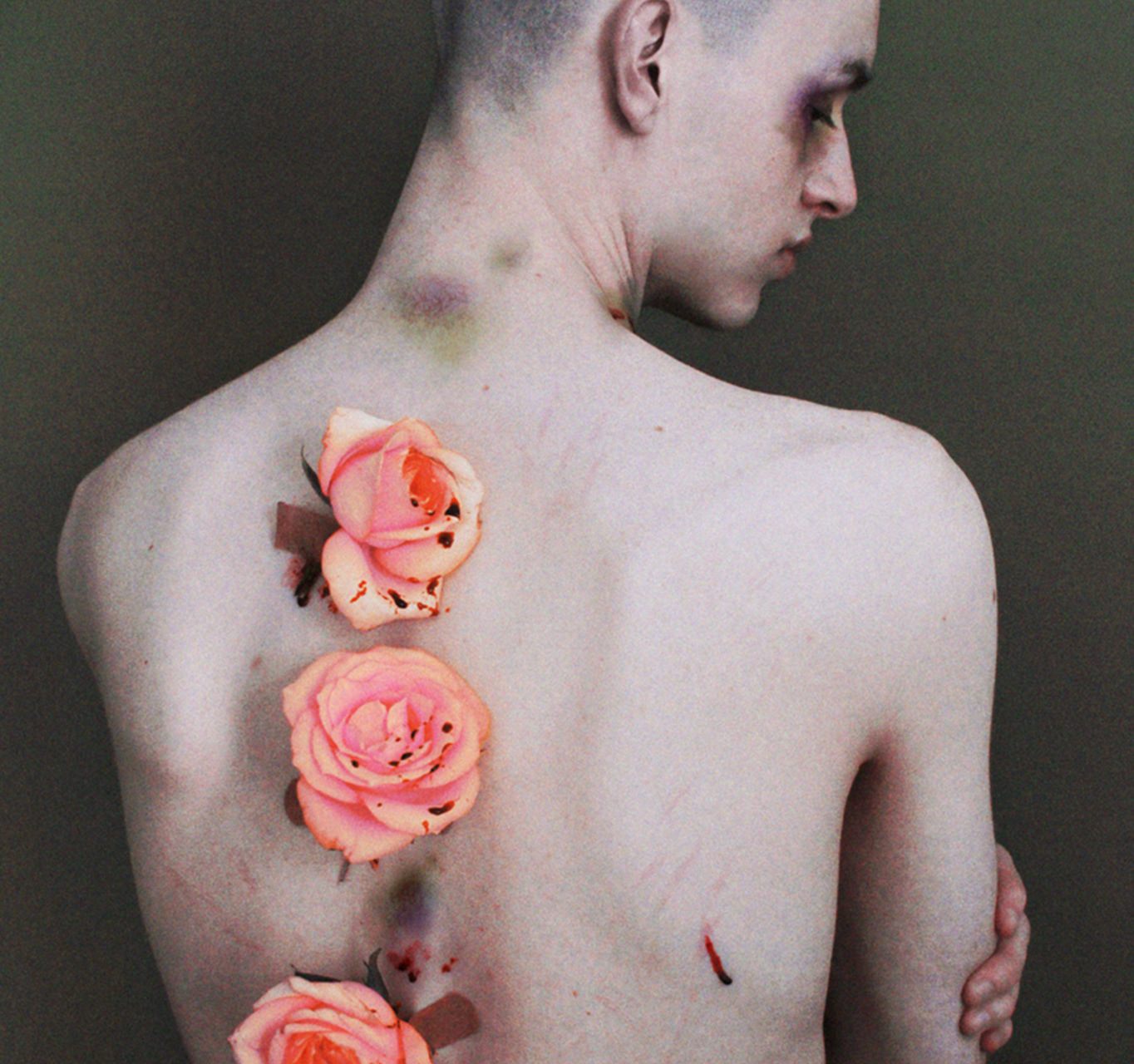 I Want You When You’re Broken