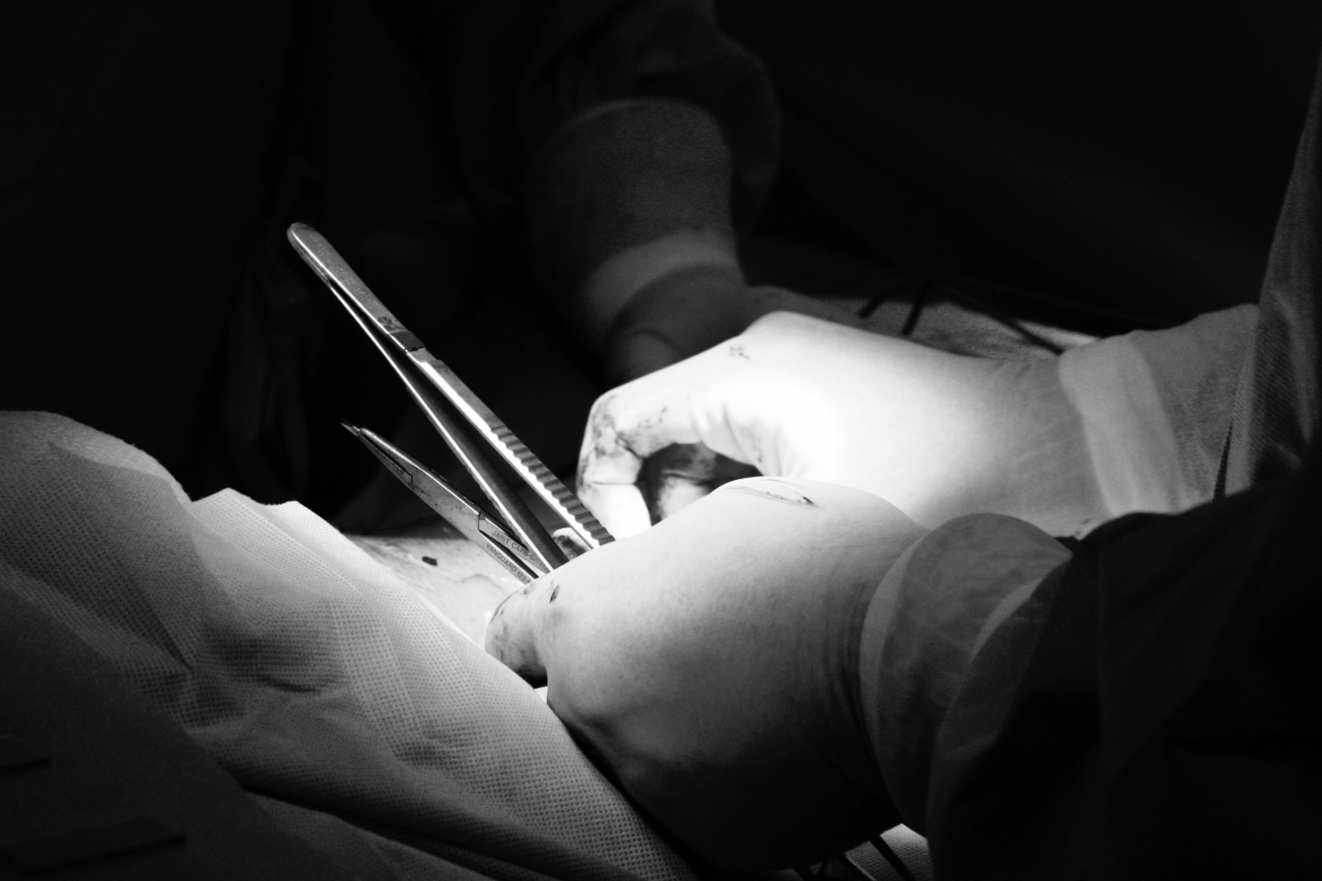33 Surgery Patients Share The Terror And Panic Of Waking Up In The Middle Of Surgery