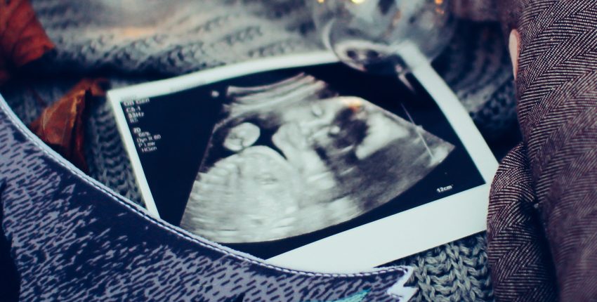 The Doctors Are Disturbed By The Ultrasound Of My Unborn Baby