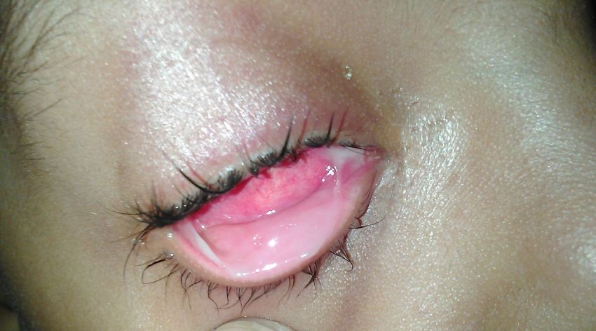 22 Men And Women Share The Grossest Thing They’ve Ever Personally Lived Through
