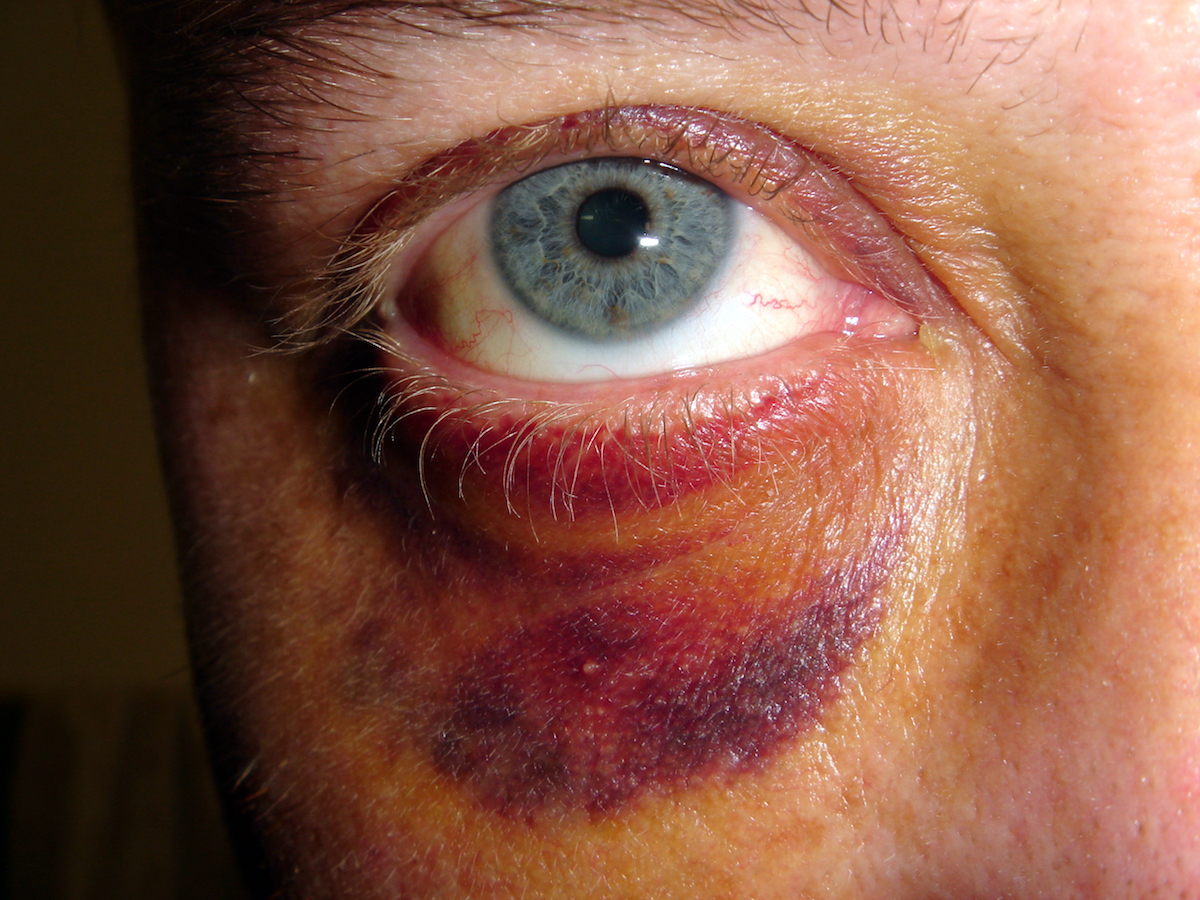24 Men Explain How They Escaped An Abusive Relationship