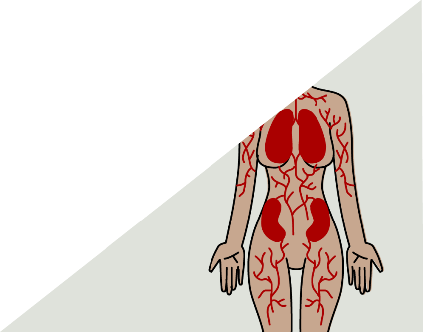 Other Immune Disorders