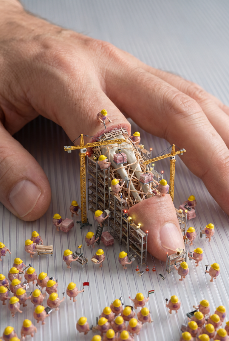 Surreal digital art of miniature construction workers in yellow hard hats building scaffolding around the tip of a human finger resting on a surface.