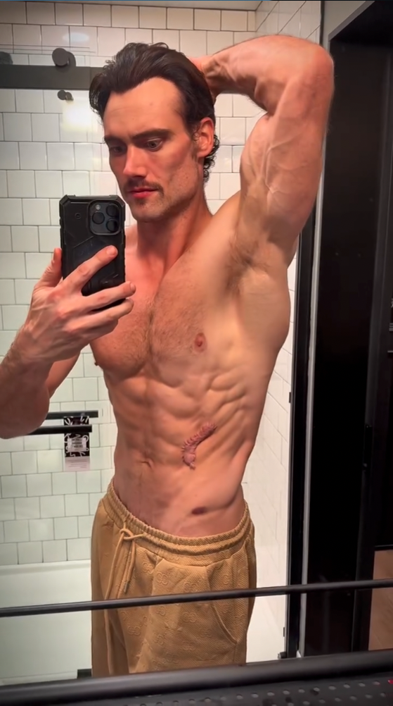 Shirtless muscular man takes a mirror selfie in a white-tiled bathroom, raising one arm to flex while displaying a scar on his side.