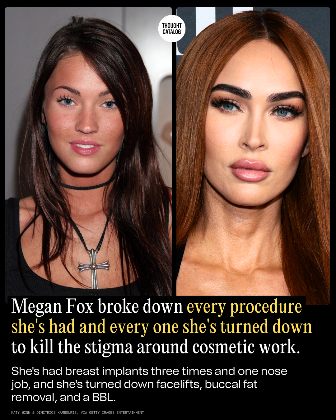 Megan Fox Then vs. Now: The Full List of Procedures She's Confirmed and the Ones She's Declined