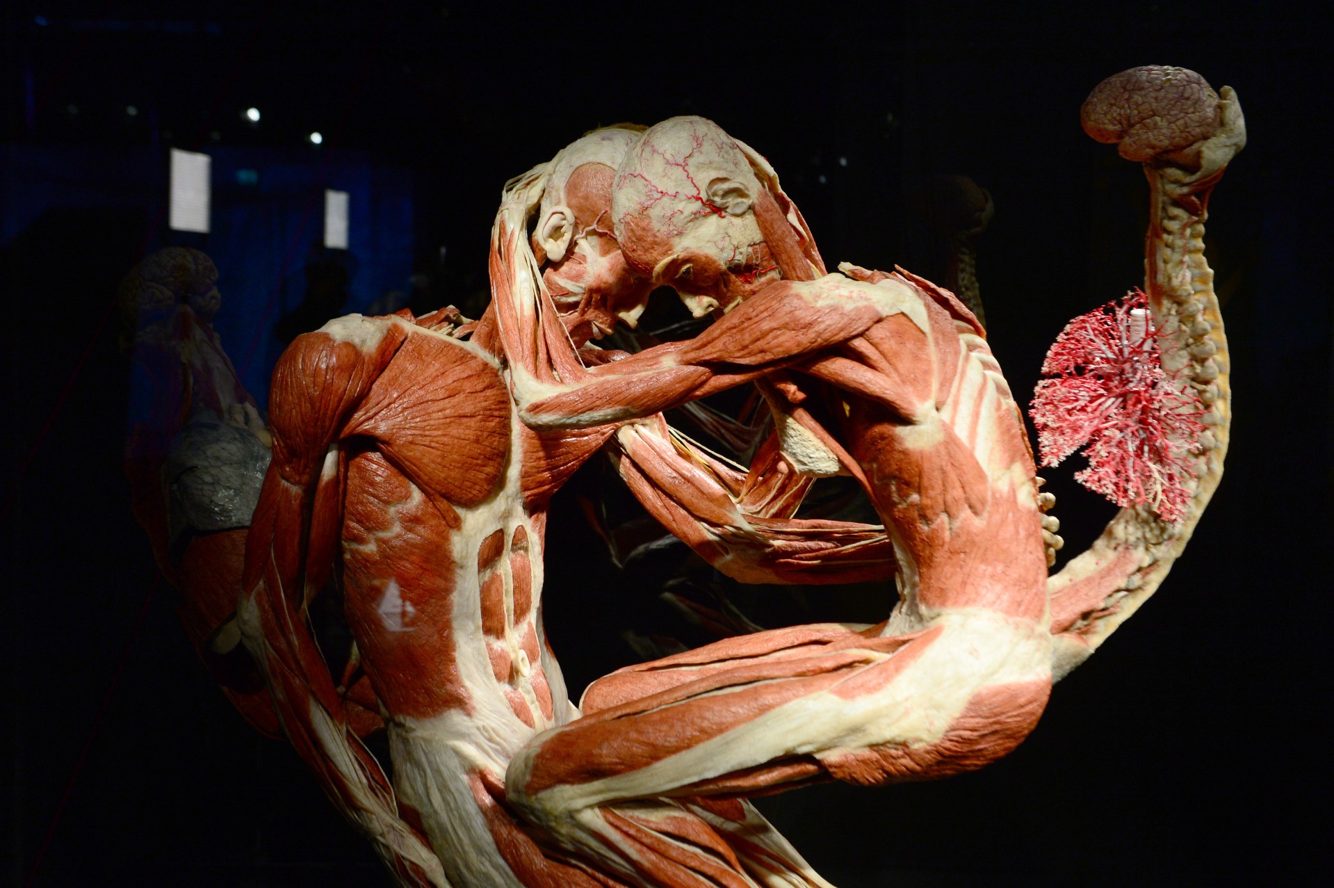 Two plastinated human figures embracing on display at the Menschen Museum in Berlin