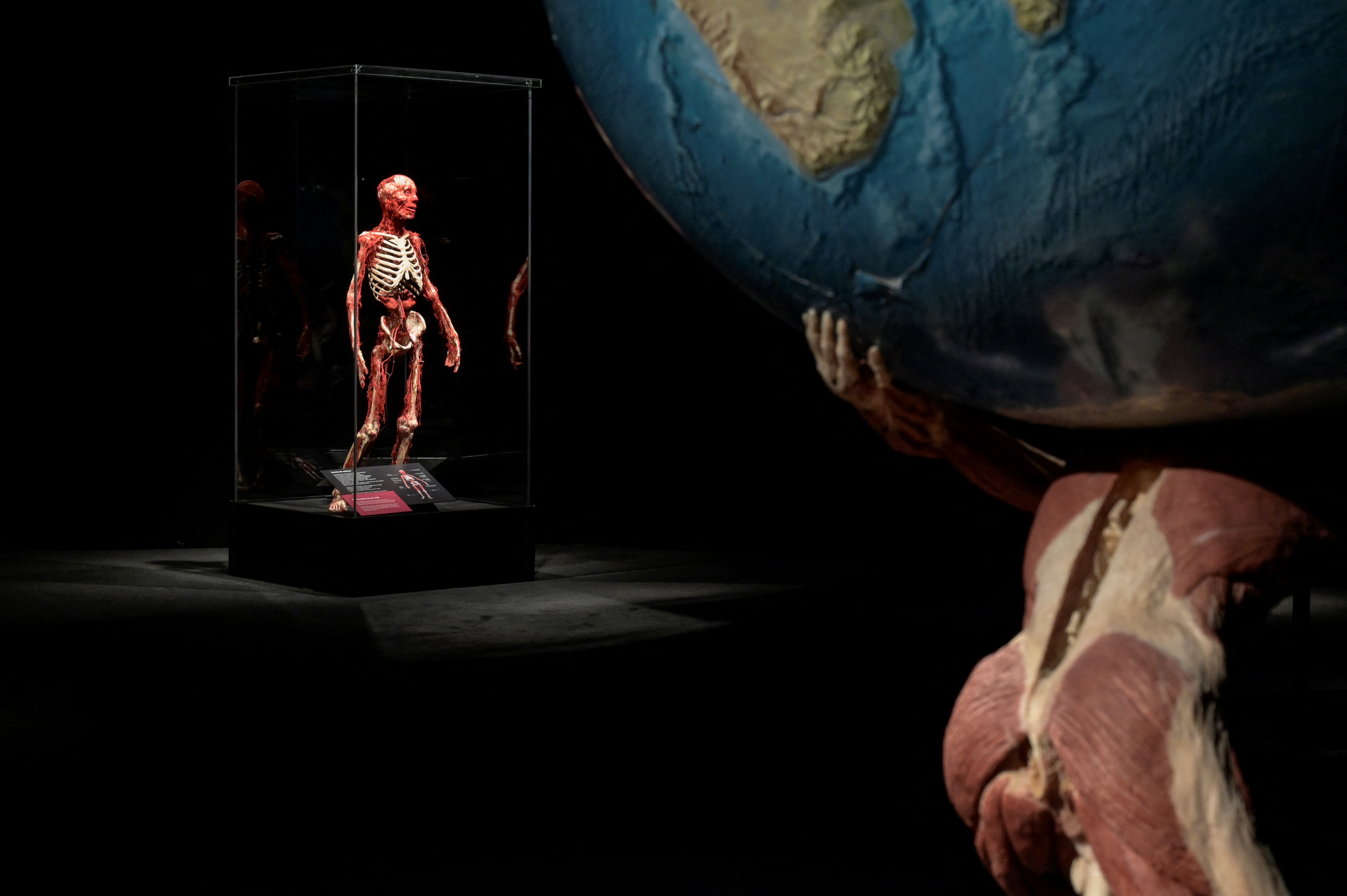 Plastinated human body specimens displayed at the Body Worlds exhibition in Madrid
