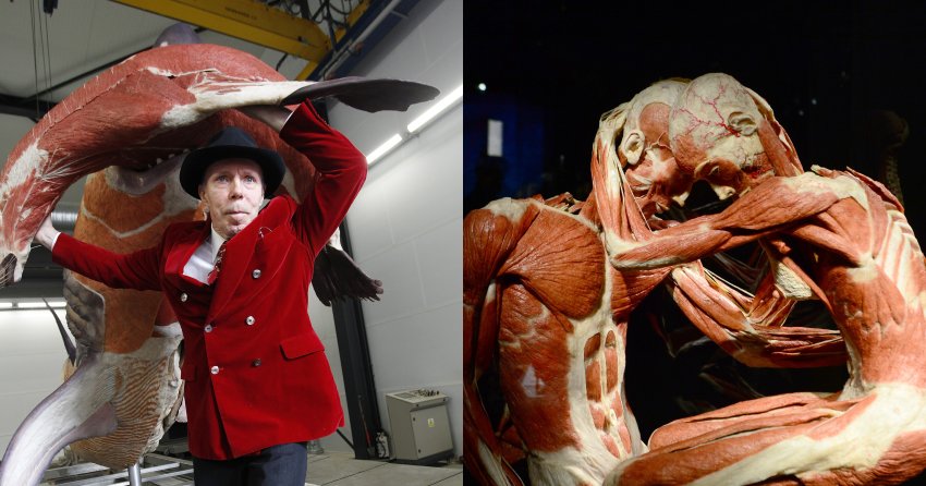 Gunther Von Hagens, the Body Worlds Creator, Died at 81 and Will Be Plastinated per His Own Plans